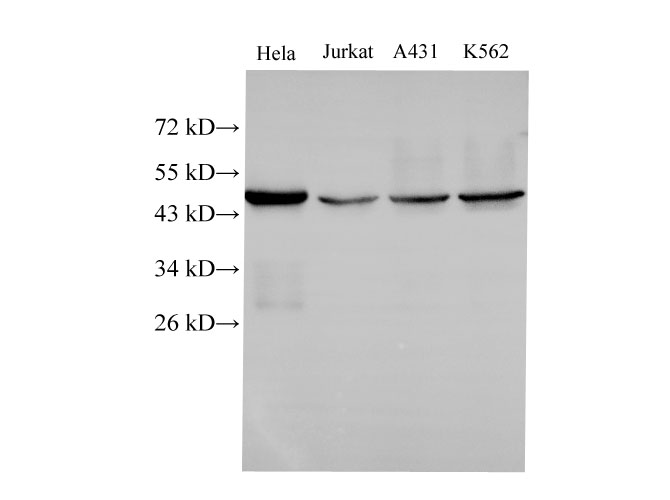 Вестерн-блоттинг, CK-18, клетки HeLa, Jurkat, A431 и K562