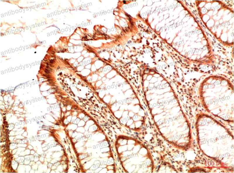 Валидация AntibodySystem RHC10009