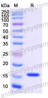 Валидация SDS-PAGE - AntibodySystem RWK25801