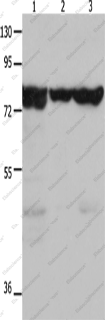 Вестерн-блоттинг, HSP75, ткань почки мыши, клетки 293T и HeLa