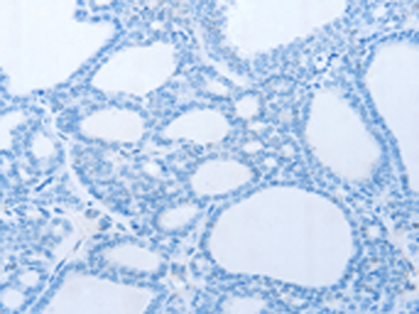 Валидация AssayVector ARM1143(396)