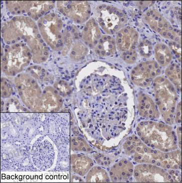 Валидация AntibodySystem RHE15801