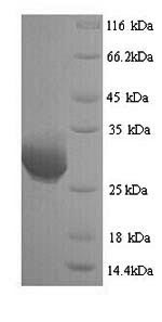 SDS-PAGE