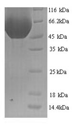 SDS-PAGE