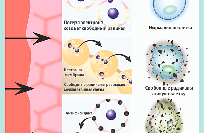Оксидативный стресс