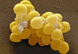 Staphylococcus aureus